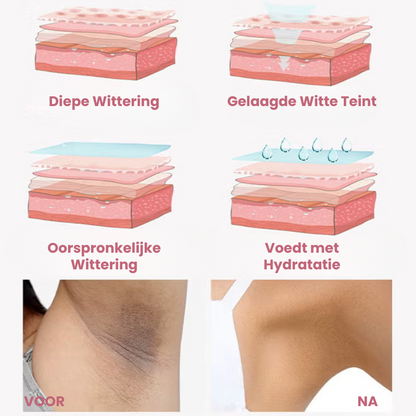 BRIGHTISSE™ | Huidoplichtende Spray