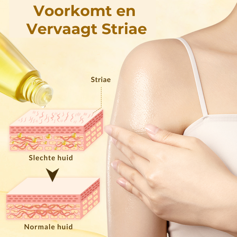 StrioLixir™ | Striaeolie