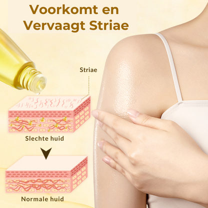 StrioLixir™ | Striaeolie