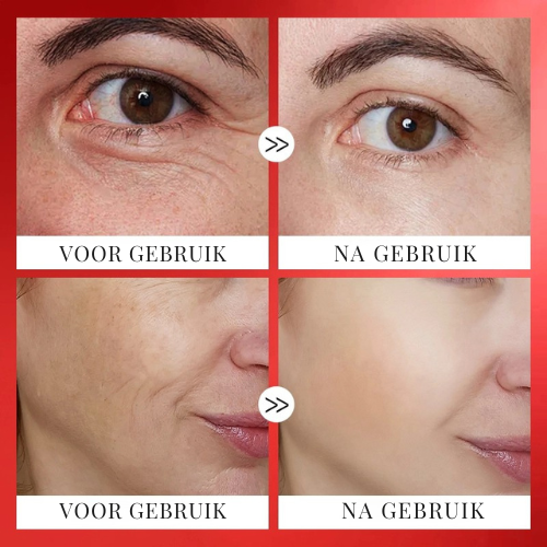 LISSEVIA™ | Anti-rimpelserum Capsule