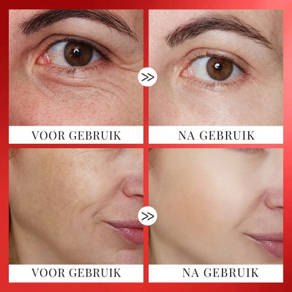 LISSEVIA™ | Anti-rimpelserum Capsule