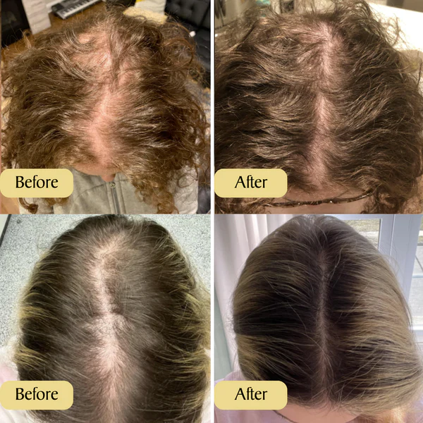 Follicle Booster™ | Natuurlijke Veganistische Haargroei Olie