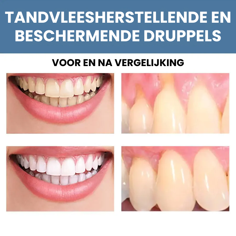 GUMMTALITY™ | Tandvleesgezondheid Druppels