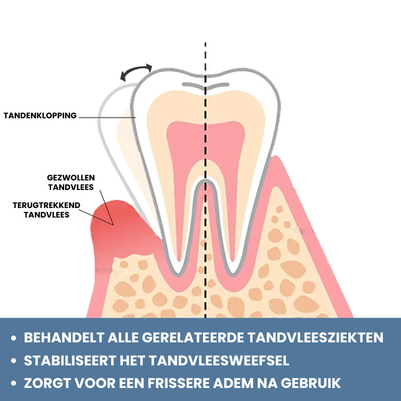 GUMMTALITY™ | Tandvleesgezondheid Druppels