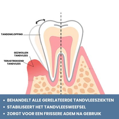 GUMMTALITY™ | Tandvleesgezondheid Druppels