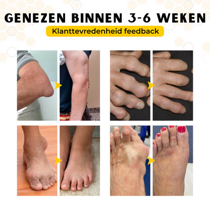 OrthoRestore™ | Gewrichtsverlichtende Crème