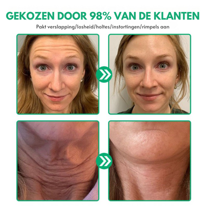 NuveaSkin™ | Rimpelverwijderende Crème