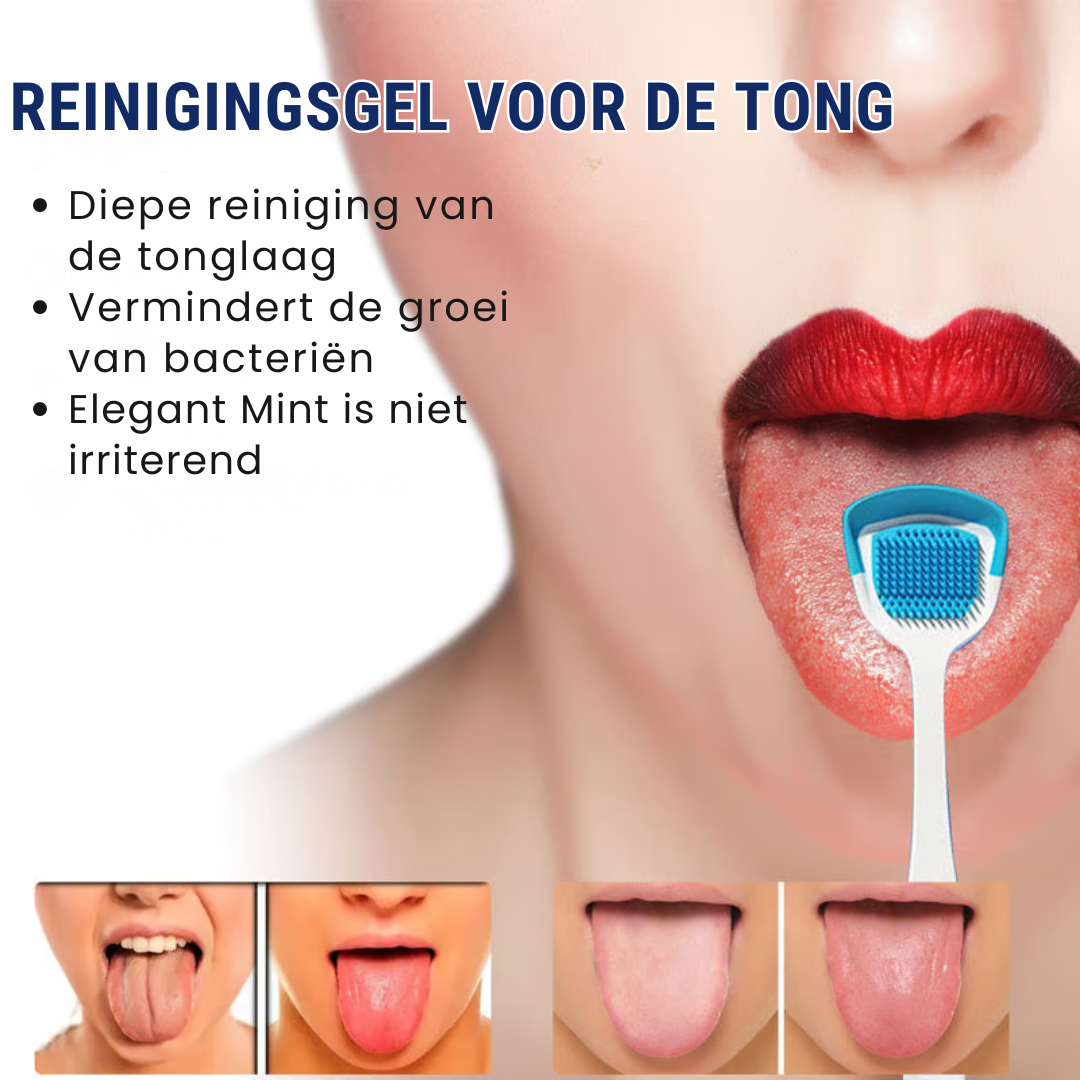 CLEANZYL™ | Tong Reinigingsgel Set