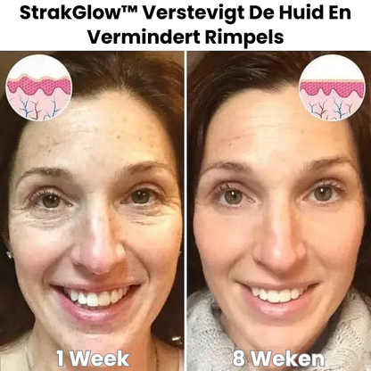 StrakGlow™ | Huidverstevigend Serum