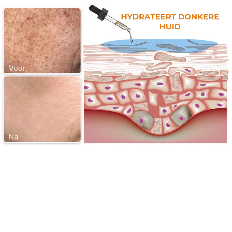 MELAMAZE™ | Melanine Corrigerend Gezichtsserum