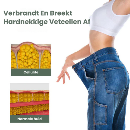 BURNYVA™ | Vetverbrandende Crème