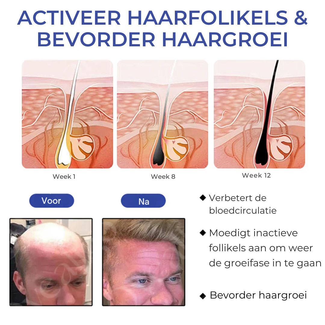 BeeGrow™ | Haargroei Olie