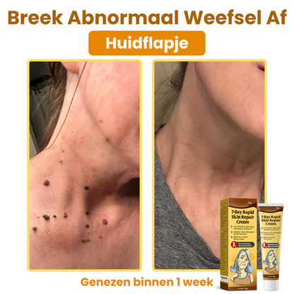 ZestyRenew™ | Huidherstelcrème