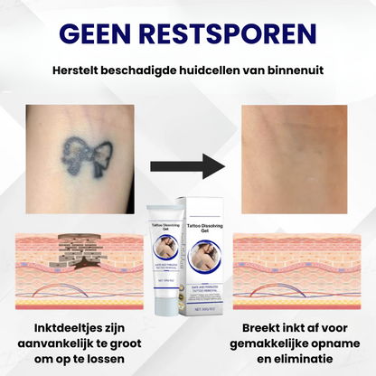 FYDETATT™ | Tatoeage Verwijdergel