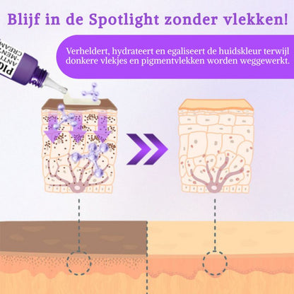 MistéqPigment™ | Anti-Hyperpigmentatiecrème