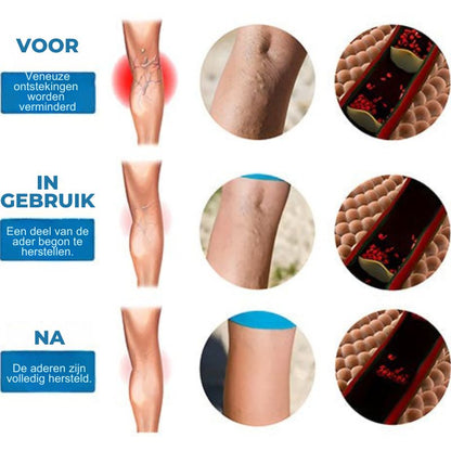 VeinRevive™ | Spataderen Herstel Crème