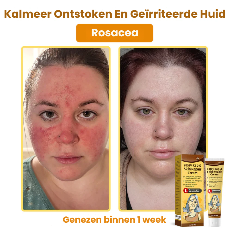 ZestyRenew™ | Huidherstelcrème