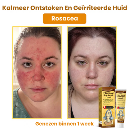 ZestyRenew™ | Huidherstelcrème