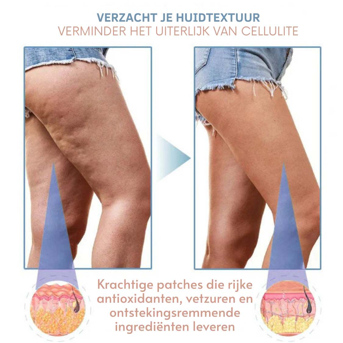 FirmiSkin™ | Anti-Cellulite Verstevigende Patches