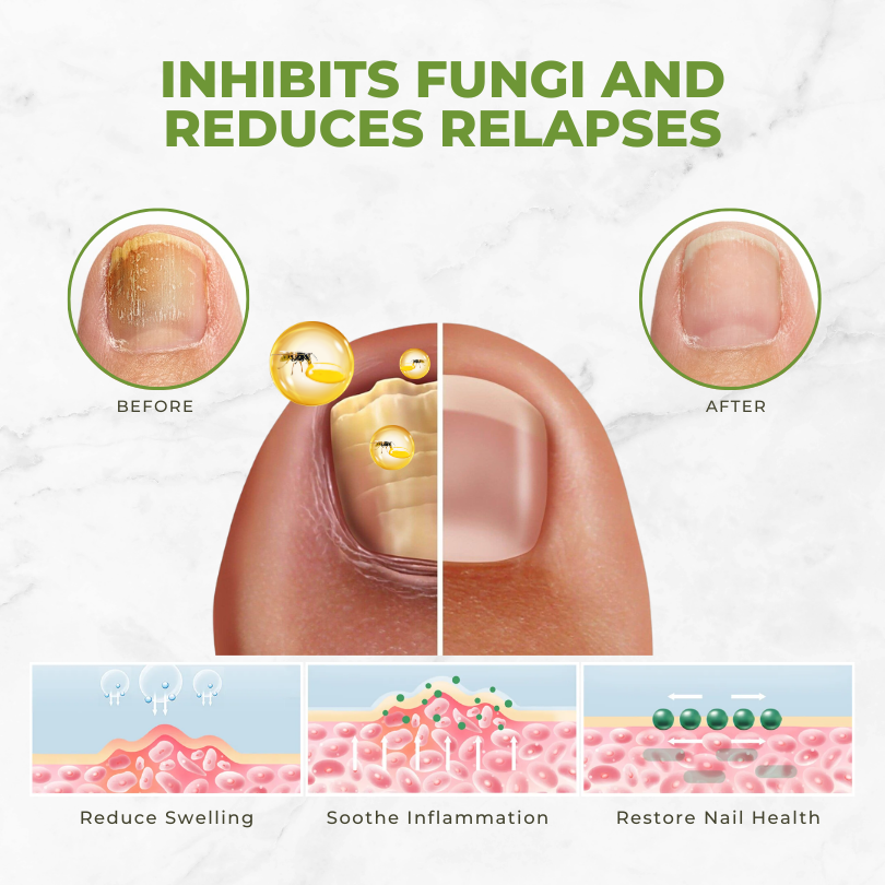 FungiVanish™ | Bijengif Nagelbehandelingsolie