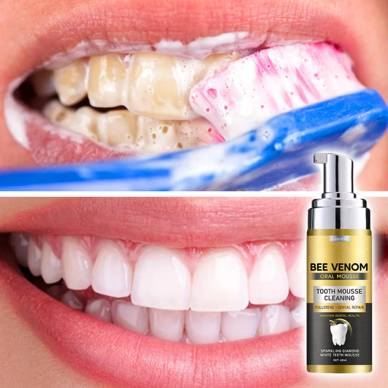 FOAMIVA™ | Tandenmousse