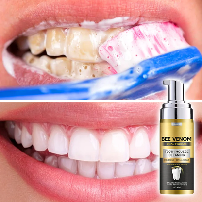 FOAMIVA™ | Tandenmousse