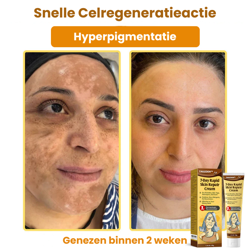 ZestyRenew™ | Huidherstelcrème