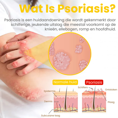 DermaZorg™ | Behandelingscrème