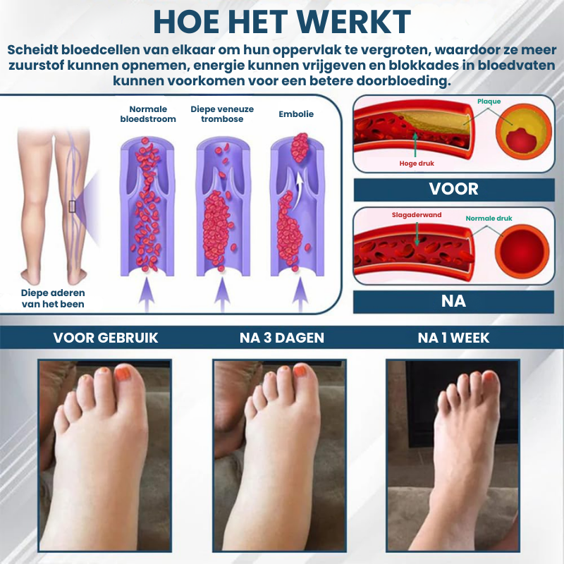 SWERELIEF™ | Zwelling Verlichtende Crème