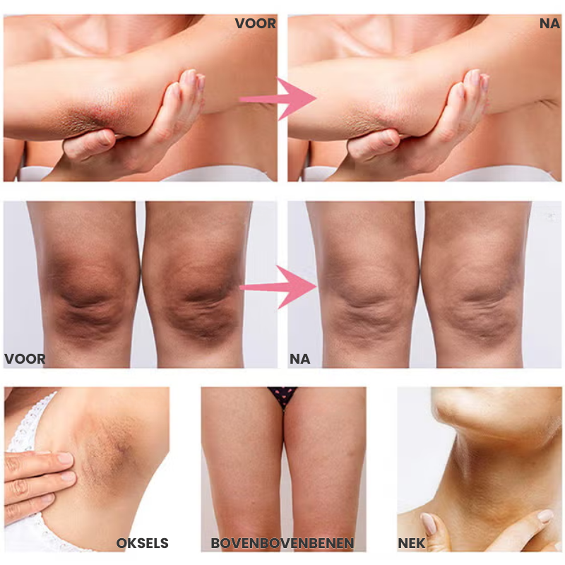 BRIGHTISSE™ | Huidoplichtende Spray