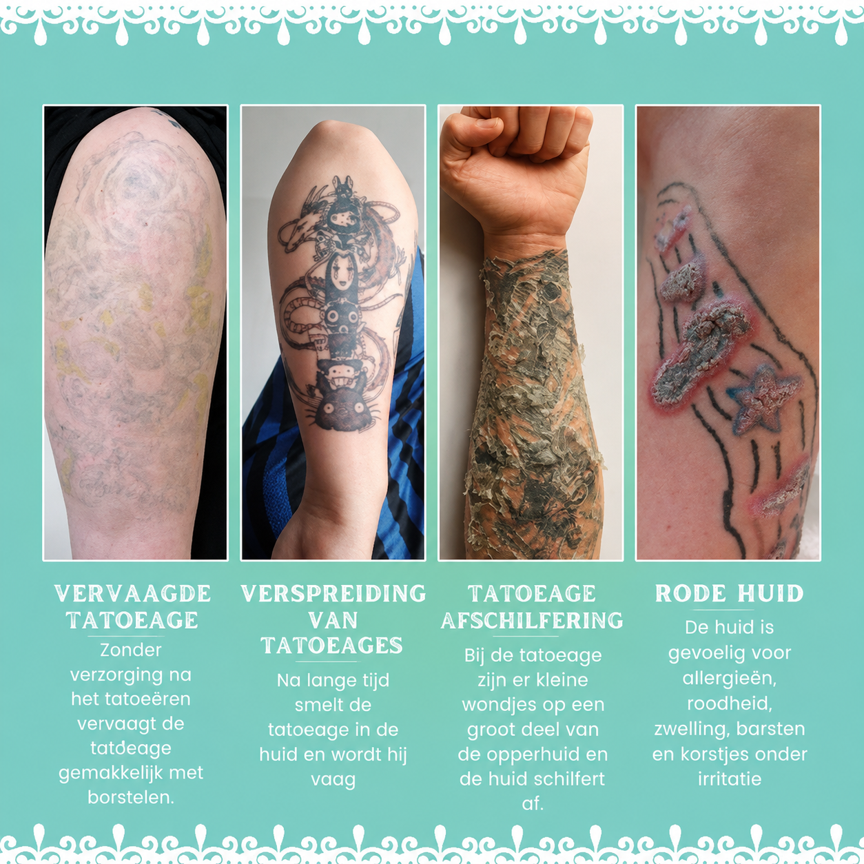 AELIXO™ | Tatoeage Verhelderende Nazorg Balsem