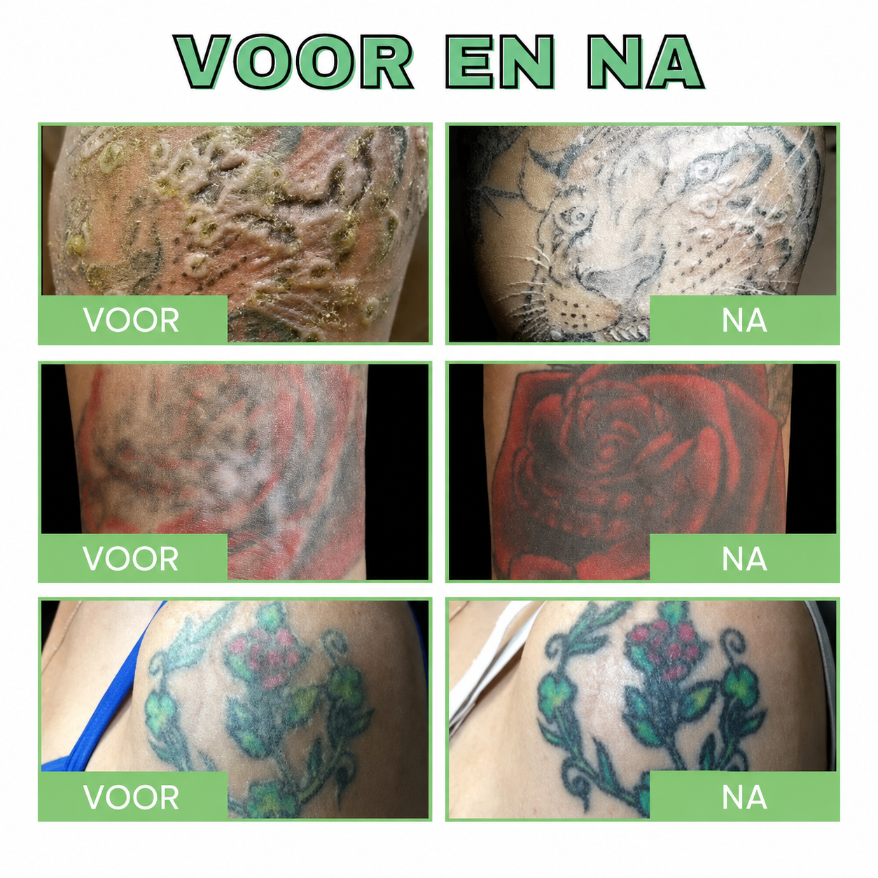 AELIXO™ | Tatoeage Verhelderende Nazorg Balsem