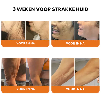 SERISTYX™ | Botox Verstevigende Serumstick