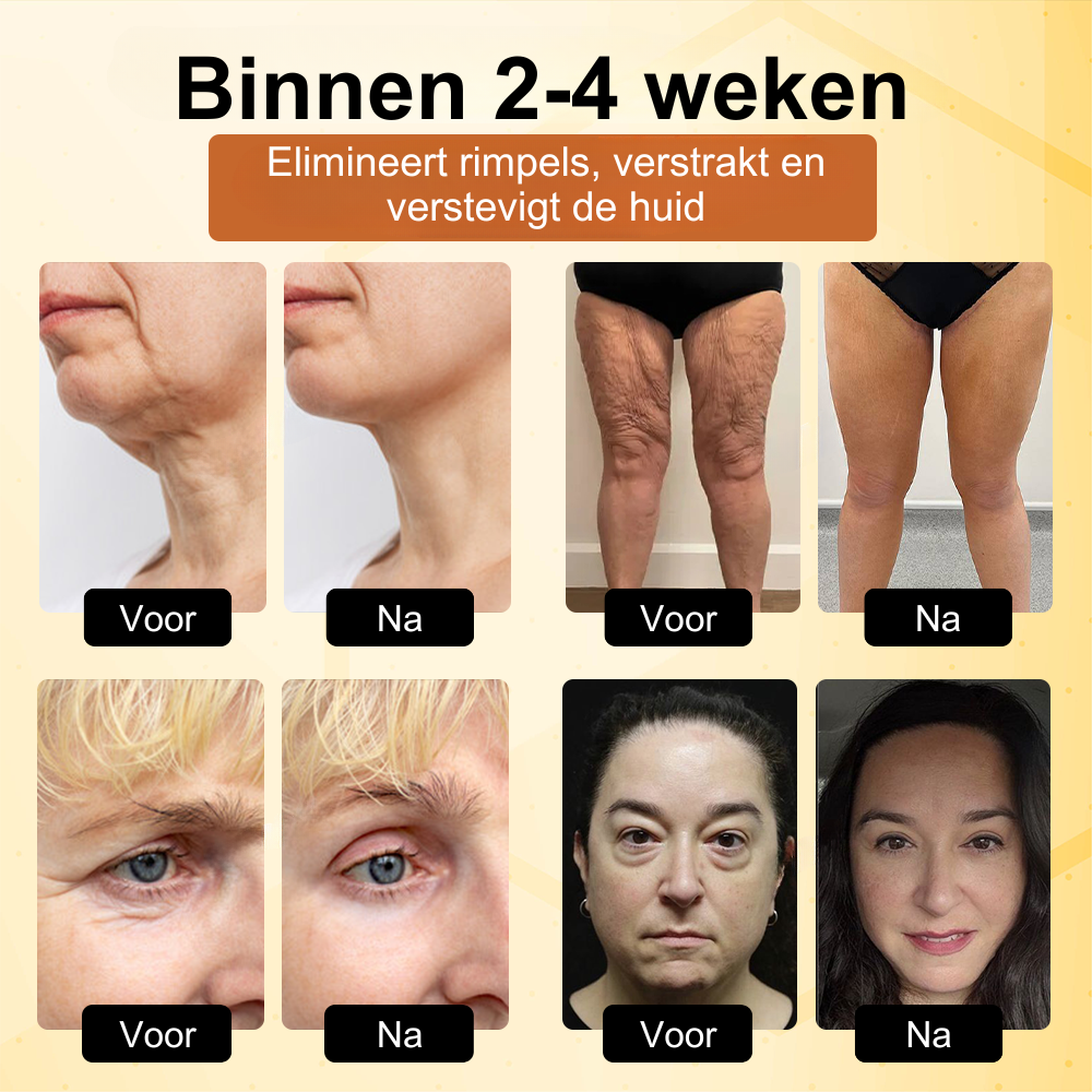 BotoxBee™ | Geavanceerde Multi-Actie Verstevigende Crème