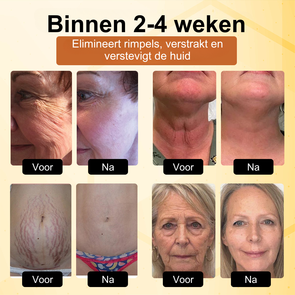 BotoxBee™ | Geavanceerde Multi-Actie Verstevigende Crème