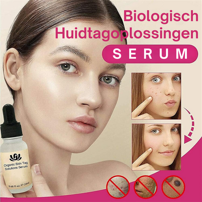 Spotless Skin™ | Biologisch Huidtagoplossingen Serum