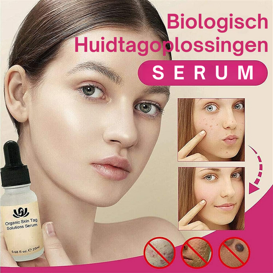 Spotless Skin™ | Biologisch Huidtagoplossingen Serum