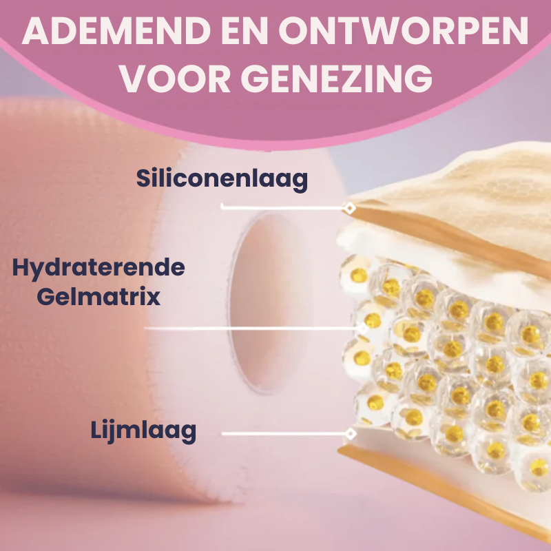 TAPELYN™ | Litteken En Rimpeltape
