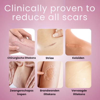 TAPELYN™ | Litteken En Rimpeltape