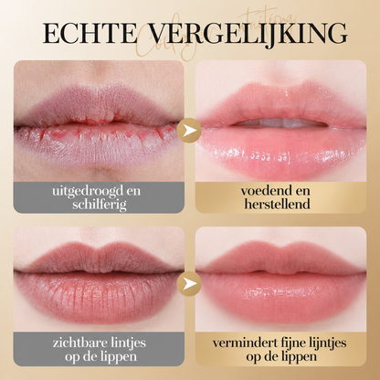 LipCare™ | Anti-aging Collageen Lippenbalsem