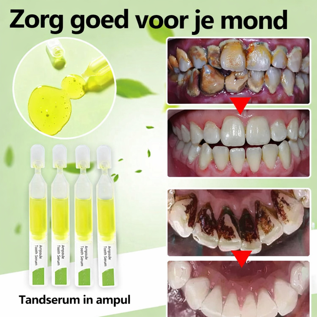 TOOTHSYTE™ | Ampul Tanden Serum