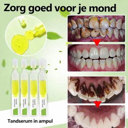 TOOTHSYTE™ | Ampul Tanden Serum