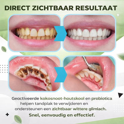 TOOTHSYTE™ | Ampul Tanden Serum