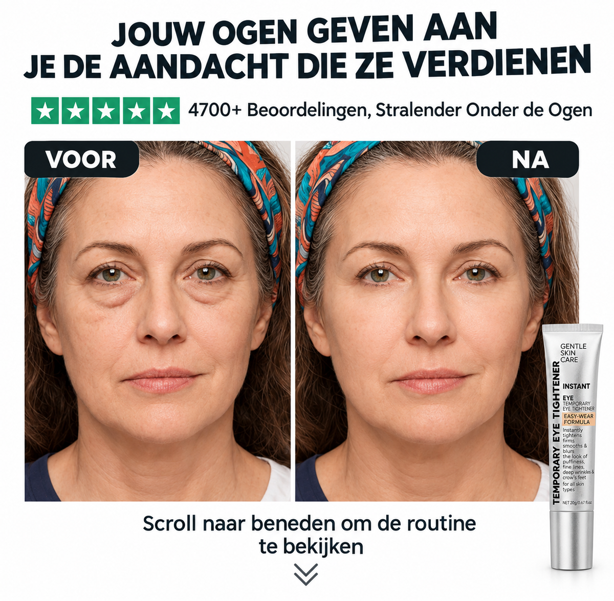 EyeLisse™ |  Oogverstrakker Tegen Veroudering