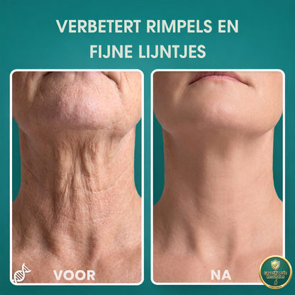 FirmLux™ | Verstevigende Crème