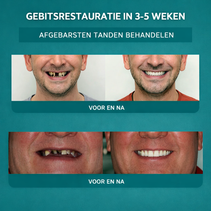 1+1 GRATIS: DentaSmile™ | Tandverzorgend Mineraalpoeder
