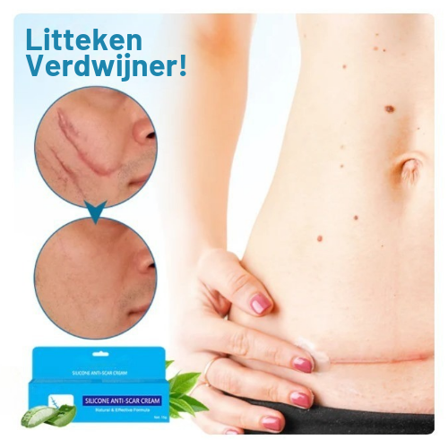 SilicFade™ | Siliconen Anti-Litteken Crème