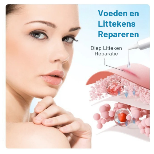 SilicFade™ | Siliconen Anti-Litteken Crème