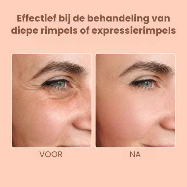 SILKY™ | Anti-Rimpel Gezicht Balsem