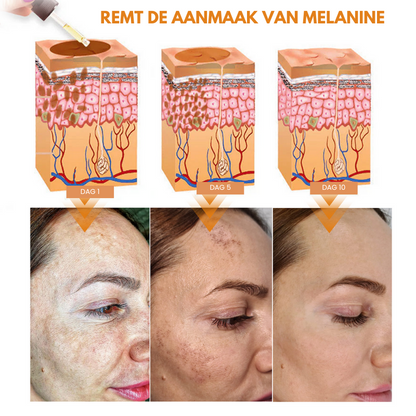 MELAMAZE™ | Melanine Corrigerend Gezichtsserum